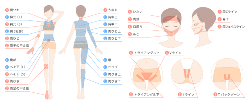 ジェイエステ　Lパーツ　Sパーツ　分類　画像