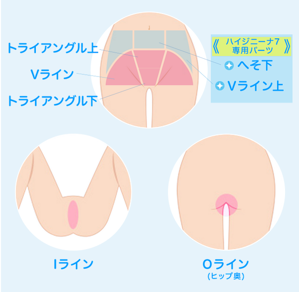 ミュゼ　ハイジニーナ7VIO脱毛　施術部位